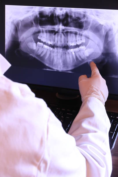 Best Dentist for Tooth Abscess  in Garnett, KS